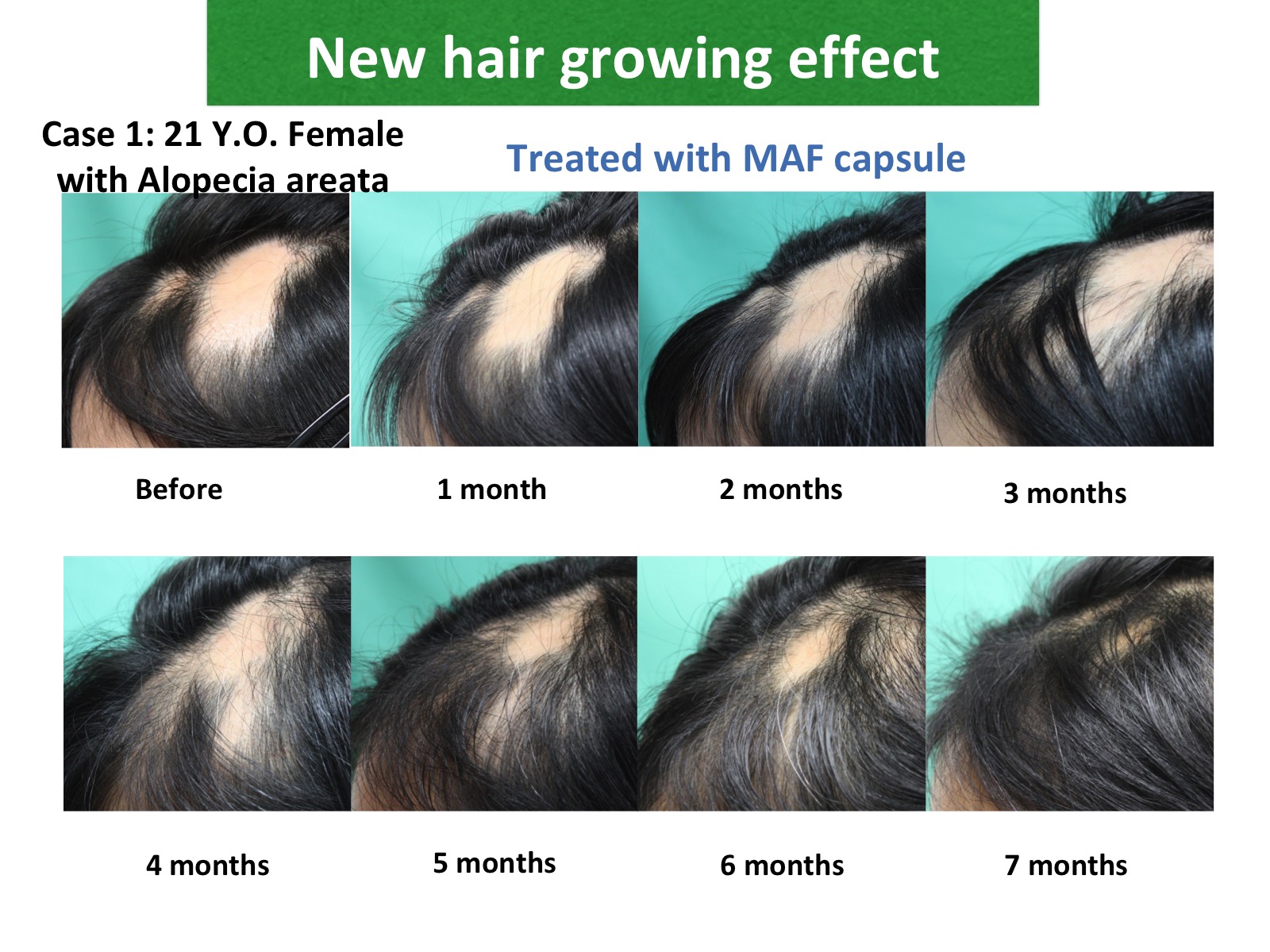 Dr. Toshio Inui presentation slide 49