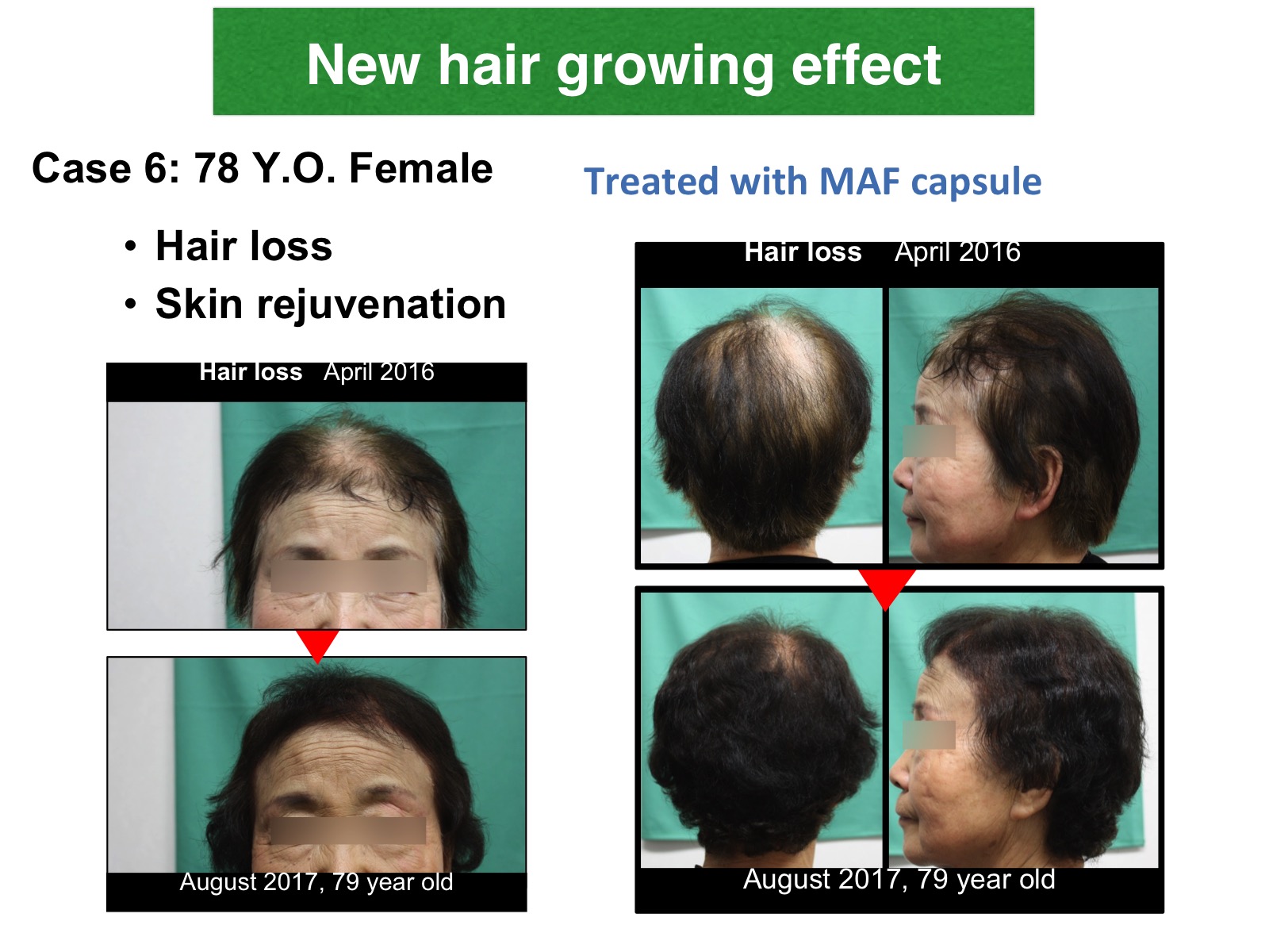 Dr. Toshio Inui presentation slide 54