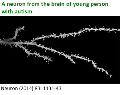 Neuron (2014): Excess synapses and pruning slowdown