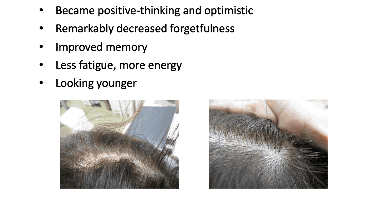 Chronic fatigue syndrome case – hair regrowth