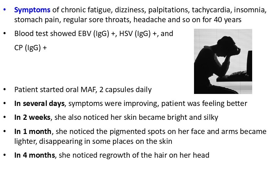 Chronic fatigue syndrome case – hair regrowth